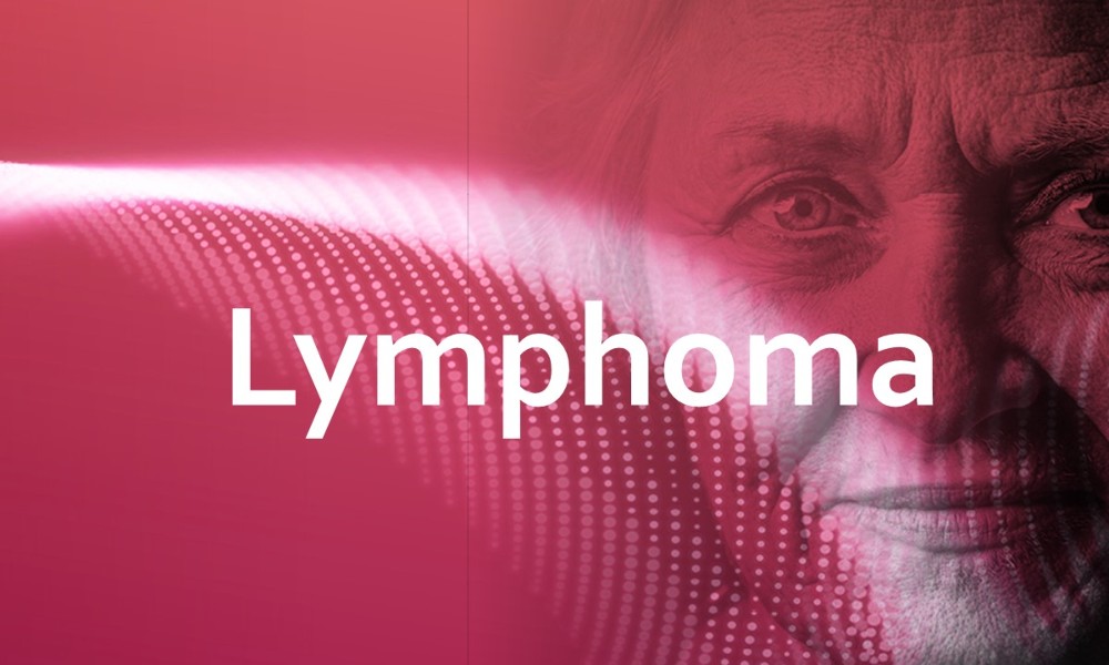 Big data to improve the care for people with Lymphoma