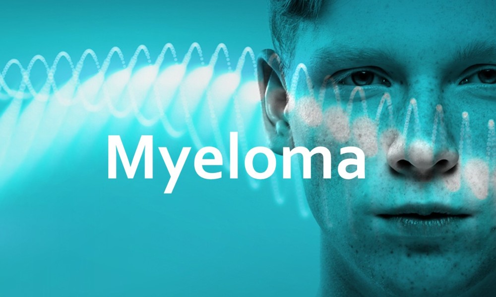 Big data to improve the care for people with Myeloma